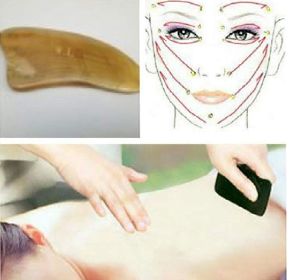 Guashaterapia